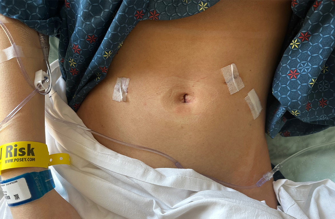 Surgical Rugines Stress-Free Surgical Planning with World-Class Concierge Service