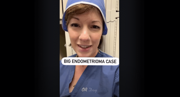 Massive Endometrioma Surgery Why Endometriomas Can Rupture
