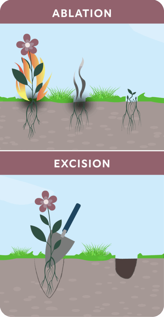 Excision Steps Endometriosis Excision: What It Is and What to Expect