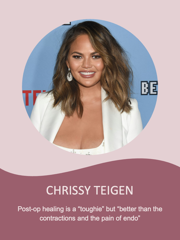 Chrissy Tigen_Endometriosis